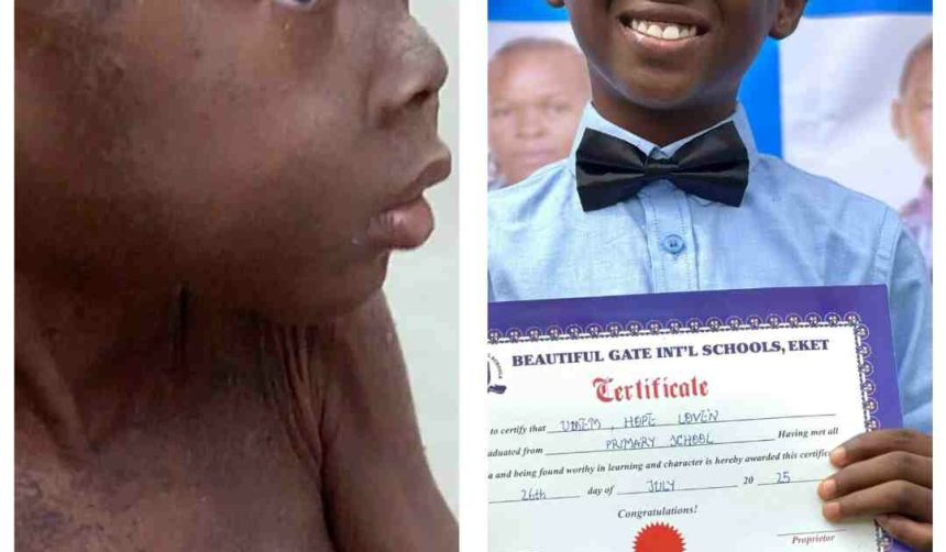 Nigerian boy branded a witch, rescued by aid worker, graduates primary school