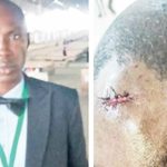 Pastor Arraigned for Tenant Assault in Asaba Court