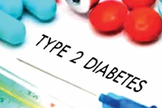 Type 2 diabetes